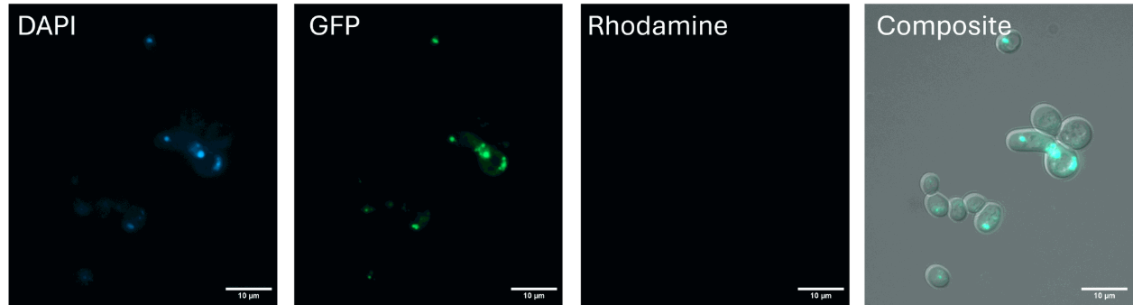 LIpiTrace, yeast, live imaging, epifluorescence